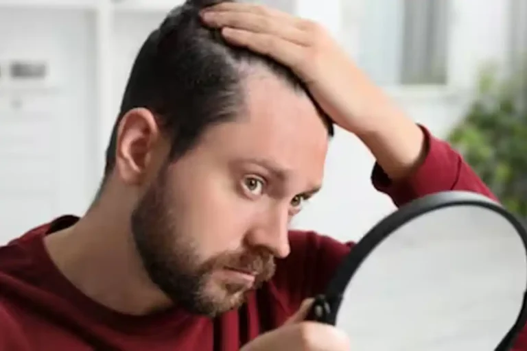 Worried About Hair Fall? Read This Before Trying Any Hair Treatment Worried About Hair Fall Heres What You Should Know Before Using Hair Growth Medicines